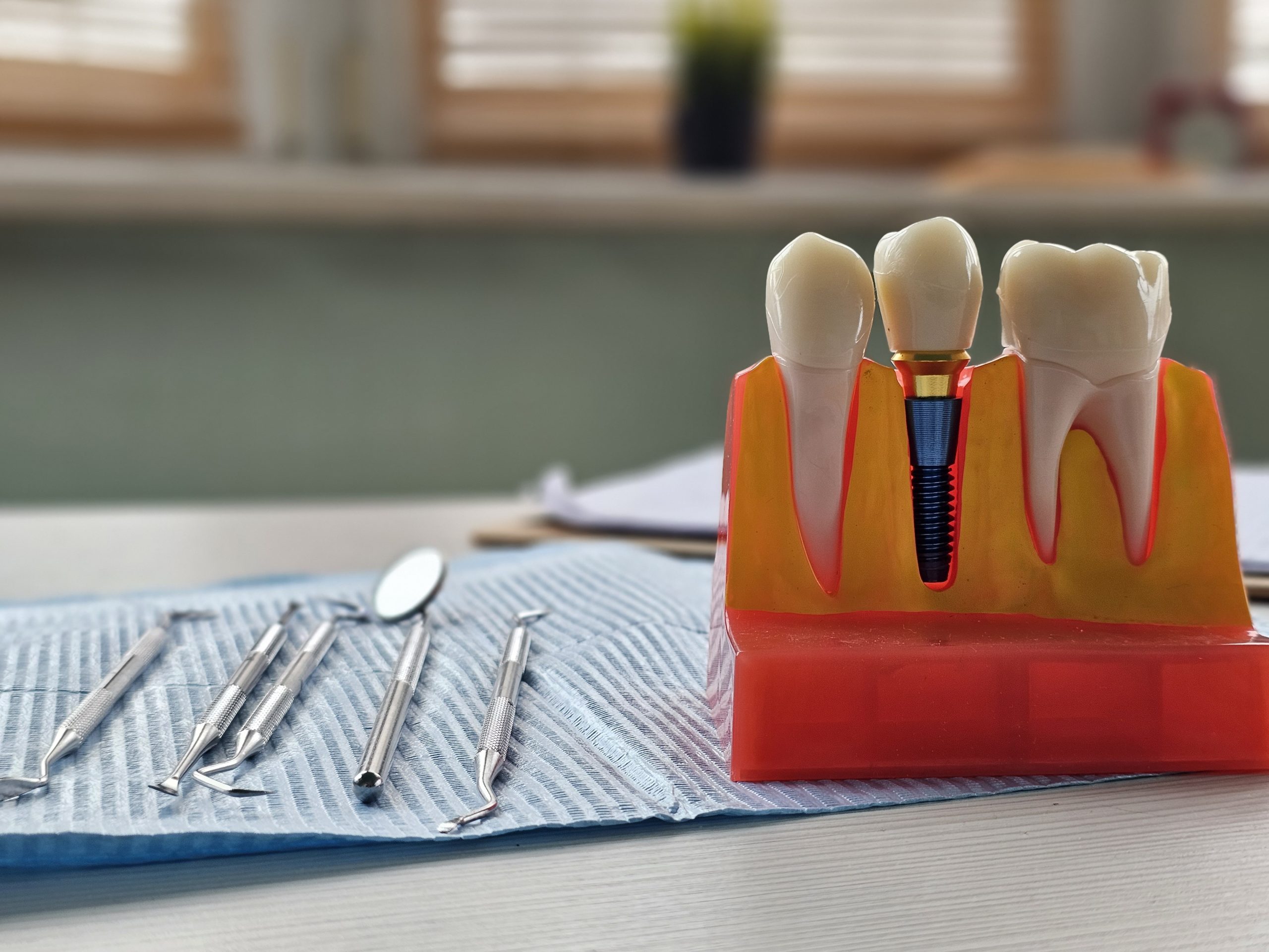 Implant dentar modern din titan utilizat la Clinica DENTORA în Chiajna