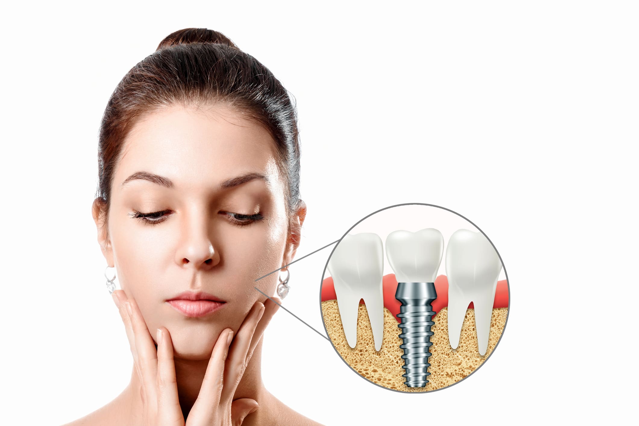 Recuperare după implant dentar la Clinica DENTORA în Chiajna – control postoperator
