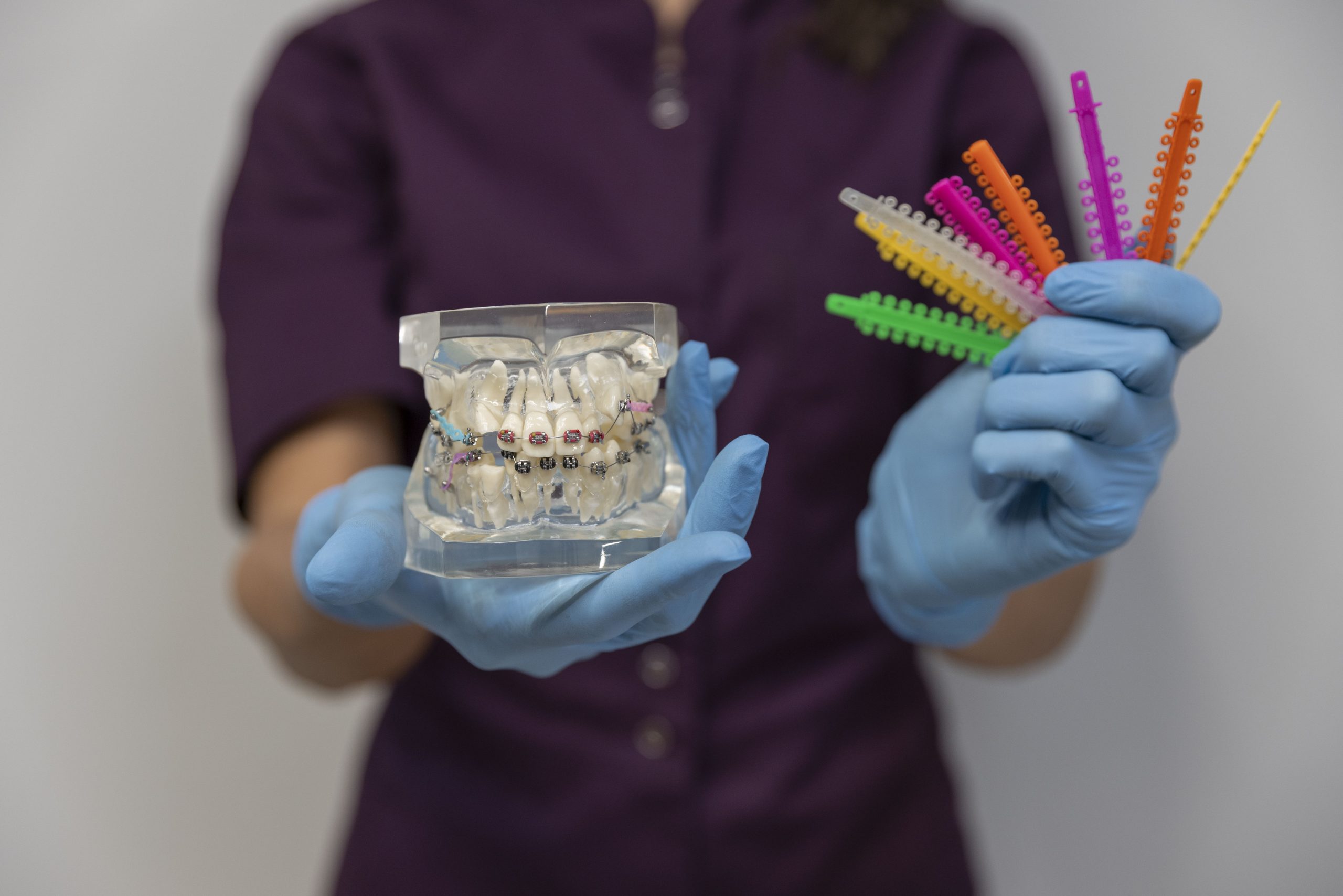 Tipuri de aparate dentare explicate la Clinica DENTORA din Chiajna
